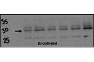 Western blot testing of DSCR1 antibody (1:500) and endothelial cell lysate. (RCAN1 抗体  (AA 75-104))