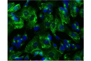 Immunofluorescence (IF) image for anti-Protein Kinase, CAMP-Dependent, Regulatory, Type II, beta (PRKAR2B) (pSer114) antibody (ABIN968875) (PRKAR2B 抗体  (pSer114))