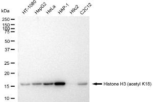 Western blotting analysis using Histone H3 (acetyl K18) antibody (ABIN7798970). (Recombinant Histone 3 抗体  (H3K18ac))