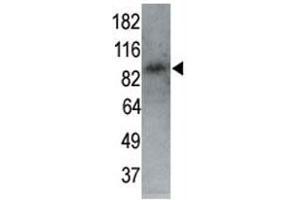 MARK1 antibody used in western blot to detect MARK1 in P7 mouse whole brain lysate (60 ug) at 1:250. (MARK1 抗体  (AA 6-40))