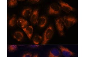 Immunofluorescence analysis of HeLa cells using NDRG4 Polyclonal Antibody at dilution of 1:100. (NDRG4 抗体)