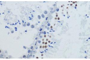 Immunohistochemistry of paraffin-embedded Mouse testis using Acetyl-Histone H4-K12 Polyclonal Antibody at dilution of 1:200 (40x lens).