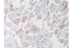 Detection of GnRH in Mouse Skeletal muscle Tissue using Polyclonal Antibody to Gonadotropin Releasing Hormone (GnRH)