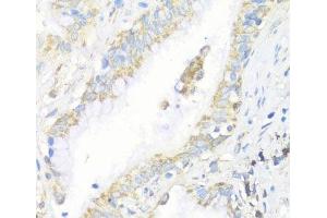 Immunohistochemistry of paraffin-embedded Human lung using EIF3J Polyclonal Antibody at dilution of 1:100 (40x lens).