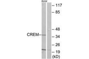 Western blot analysis of extracts from RAW264. (CREM 抗体  (AA 81-130))