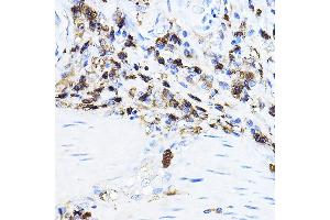 Immunohistochemistry (IHC) image for anti-Lymphocyte-Specific Protein tyrosine Kinase (LCK) (AA 1-240) antibody (ABIN3023130)