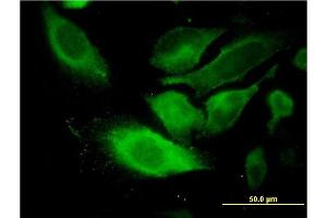 Immunofluorescence of monoclonal antibody to TSSC1 on HeLa cell. (TSSC1 抗体  (AA 288-387))