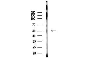 Western blot analysis of lysates from EC304 cells(heat-shock, 45 min treatment), using beta I Tubulin Antibody at 1/1000 dilution.