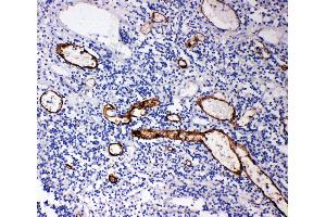 Immunohistochemistry (IHC) image for anti-Mucosal Vascular Addressin Cell Adhesion Molecule 1 (MADCAM1) (AA 173-190), (Middle Region) antibody (ABIN3044076)