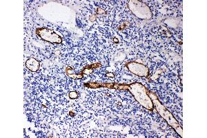 Anti-MAdCAM1 antibody, IHC(P) IHC(P): Human Appendicitis Tissue (MADCAM1 抗体  (Middle Region))