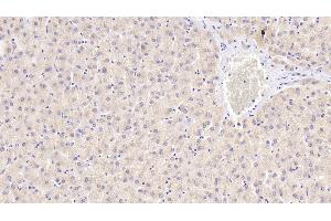 Detection of ENDOG in Human Liver Tissue using Polyclonal Antibody to Endonuclease G, Mitochondrial (ENDOG) (Endonuclease G 抗体  (AA 16-290))