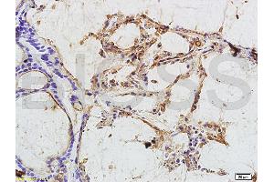 Immunohistochemistry (IHC) image for anti-Carcinoembryonic Antigen Gene Family (CEA) antibody (ABIN722931) (CEA 抗体)