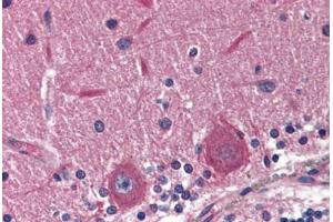 Human Brain, Cerebellum (formalin-fixed, paraffin-embedded) stained with EXOC4 antibody ABIN364381 at 5 ug/ml followed by biotinylated anti-mouse IgG secondary antibody ABIN481714, alkaline phosphatase-streptavidin and chromogen. (Sec8 抗体)