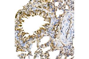 Immunohistochemistry of paraffin-embedded rat lung using ERK1/2 Rabbit mAb (ABIN7268620) at dilution of 1:100 (40x lens). (ERK1 抗体)