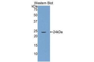 Western Blotting (WB) image for anti-Glutamate Receptor Interacting Protein 1 (GRIP1) (AA 79-268) antibody (ABIN1859070) (GRIP1 抗体  (AA 79-268))
