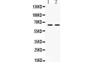 Western blot analysis of HnRNP L expression in PANC whole cell lysates ( Lane 1) and JURKAT whole cell lysates ( Lane 2). (HNRNPL 抗体  (C-Term))