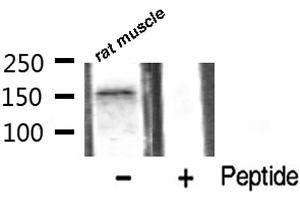 Western blot analysis of VEGFR2 phosphorylation expression in rat muscle tissue lysates,The lane on the right is treated with the antigen-specific peptide. (VEGFR2/CD309 抗体  (pTyr1059))