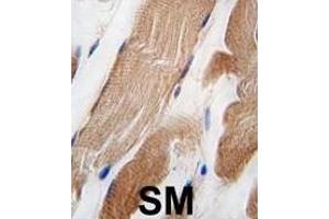 Formalin-fixed and paraffin-embedded human skeletal muscle tissue reacted with ILK Antibody  f antibody, which was peroxidase-conjugated to the secondary antibody, followed by DAB staining. (ILK 抗体  (AA 151-180))
