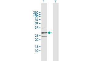 Western Blot analysis of HSD17B8 expression in transfected 293T cell line by HSD17B8 MaxPab polyclonal antibody. (HSD17B8 抗体  (AA 1-261))