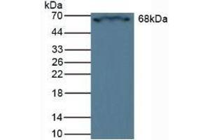 Detection of CRAT in Rat Heart Tissue using Polyclonal Antibody to Carnitine Acetyltransferase (CRAT) (CRAT 抗体  (AA 55-256))