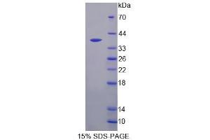 Image no. 1 for RIO Kinase 1 (RIOK1) (AA 180-479) protein (His tag) (ABIN6239985)