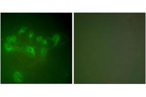 Immunofluorescence analysis of A549 cells, using MDM2 Antibody. (MDM2 抗体  (AA 391-440))