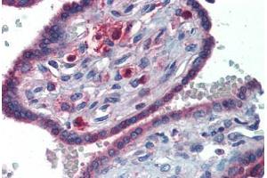 Human Placenta (formalin-fixed, paraffin-embedded) stained with GATA6 antibody ABIN462170 followed by biotinylated goat anti-rabbit IgG secondary antibody ABIN481713, alkaline phosphatase-streptavidin and chromogen. (GATA6 抗体  (C-Term))