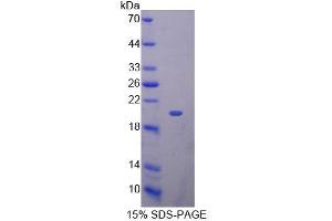 SDS-PAGE analysis of Mouse KLRK1 Protein. (KLRK1 蛋白)
