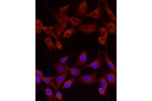 Immunofluorescence analysis of NIH-3T3 using Cortactin antibody (ABIN6127722, ABIN6139243, ABIN6139244 and ABIN6221478) at dilution of 1:25 (40x lens). (Cortactin 抗体  (AA 214-513))