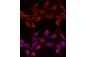 Immunofluorescence analysis of NIH-3T3 using Cortactin antibody (ABIN6127722, ABIN6139243, ABIN6139244 and ABIN6221478) at dilution of 1:25 (40x lens). (Cortactin 抗体  (AA 214-513))