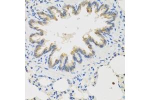 Immunohistochemistry of paraffin-embedded rat lung using TICAM1 antibody. (TICAM1 抗体  (AA 20-200))