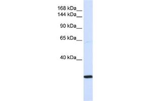 WB Suggested Anti-SMC2 Antibody Titration:  0. (SMC2 抗体  (N-Term))