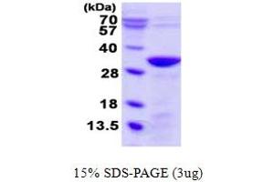 Unc-119 Homolog B (UNC119B) (AA 1-251) protein (His tag)