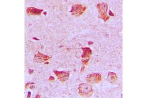 Immunohistochemistry (IHC) image for anti-NADH Dehydrogenase (Ubiquinone) 1 alpha Subcomplex, 8, 19kDa (NDUFA8) (Center) antibody (ABIN7296392)