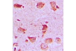 Immunohistochemical analysis of NDUFA8 staining in human brain formalin fixed paraffin embedded tissue section. (NDUFA8 抗体  (Center))
