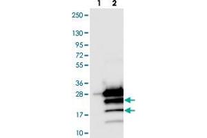 Western blot analysis of Lane 1: Negative control (vector only transfected HEK293T lysate). (PPP1R14D 抗体)