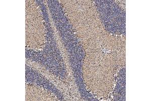 IHC analysis of SFXN5 using anti-SFXN5 antibody (ABIN7601388). (Sideroflexin 5 抗体  (AA 34-340))