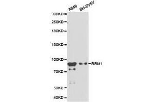 Western Blotting (WB) image for anti-Ribonucleotide Reductase M1 (RRM1) antibody (ABIN1874668) (RRM1 抗体)