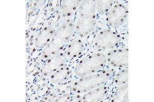 Immunohistochemistry of paraffin-embedded mouse kidney using Phospho-c-Jun-T91 Rabbit pAb (ABIN7268058) at dilution of 1:50 (40x lens). (C-JUN 抗体  (pThr91))