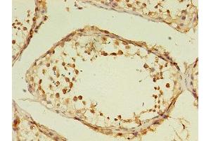 Immunohistochemistry (IHC) image for anti-G Protein-Coupled Receptor Kinase 4 (GRK4) (AA 1-245) antibody (ABIN7153293)