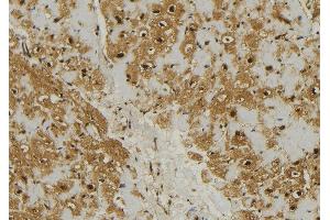 Immunohistochemistry (IHC) image for anti-Mitochondrial Ribosomal Protein L11 (MRPL11) (Internal Region) antibody (ABIN6257350)