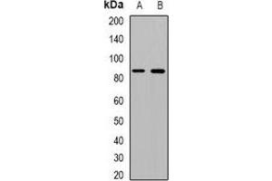 Western blot analysis of Beta Amyloid expression in mouse kidney (A), mouse heart (B) whole cell lysates. (beta Amyloid 抗体)