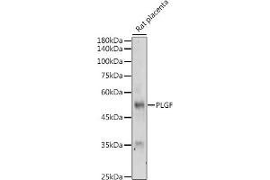 Western blot analysis of extracts of Rat placenta, using PLGF antibody (ABIN7269385) at 1:500 dilution. (PLGF 抗体)