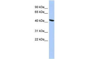 Human PANC1; WB Suggested Anti-ZNF71 Antibody Titration: 1 ug/ml. (ZNF71 抗体)