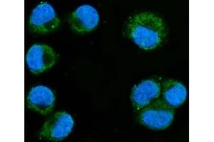 IF analysis of MIRO1/RHOT1 using anti-MIRO1/RHOT1 antibody (ABIN7602209).