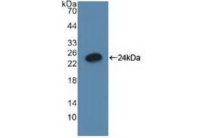 Western blot analysis of recombinant Human GADD45a. (GADD45A 抗体  (AA 1-165))
