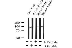 Western blot analysis of Phospho-PKCD (Tyr64) expression in various lysates (PKC delta 抗体  (pTyr64))