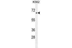 ZN169 Antibody (N-term) western blot analysis in K562 cell line lysates (35 µg/lane). (ZNF169 抗体  (N-Term))