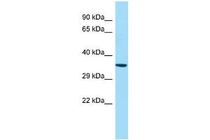 WB Suggested Anti-GPR160 Antibody Titration: 1. (GPR160 抗体  (N-Term))