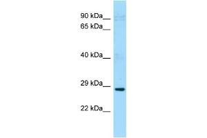 WB Suggested Anti-Pdcl2 Antibody Titration: 1. (PDCL2 抗体  (N-Term))